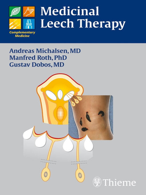 Title details for Medicinal Leech Therapy by Gustav Dobos - Wait list